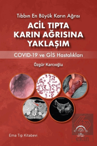 Acil Tıpta Karın Ağrısına Yaklaşım