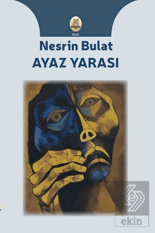 Ayaz Yarası