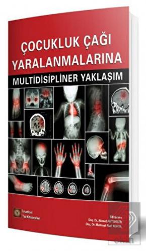 Çocukluk Çağı Yaralanmalarına Multidisipliner Yakl