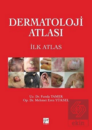 Dermatoloji Atlası