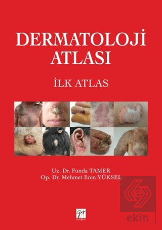 Dermatoloji Atlası