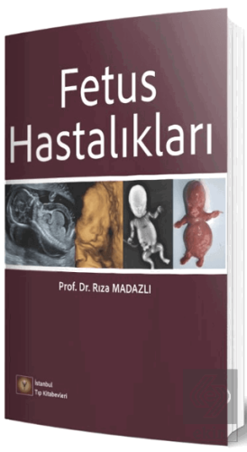 Fetus Hastalıkları