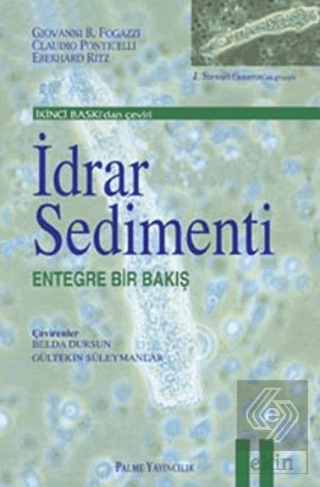 İdrar Sedimenti