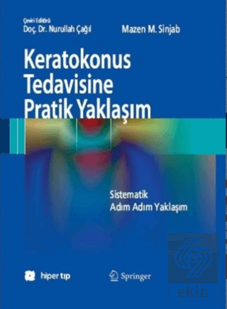 Keratokonus Tedavisine Pratik Yaklaşım