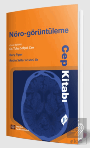 Nöro-görüntüleme Cep Kitabı