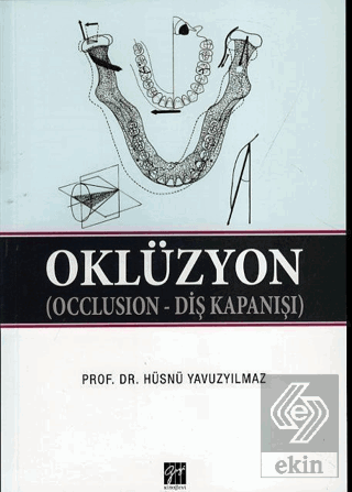 Oklüzyon