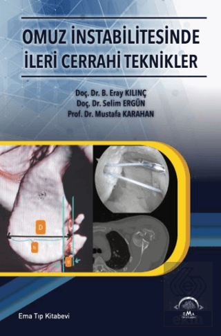 Omuz İntabilitesinde İleri Cerrahi Teknikler