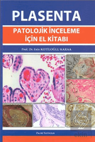 Plasenta Patolojik İnceleme İçin El Kitabı