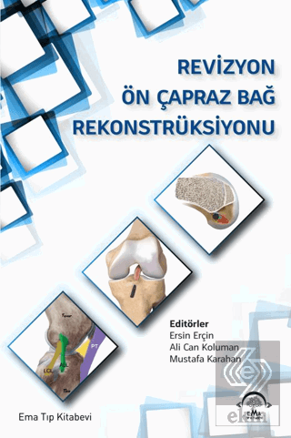 Revizyon Ön Çapraz Bağ Rekonstrüksiyonu