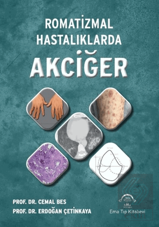 Romatizmal Hastalıklarda Akciğer