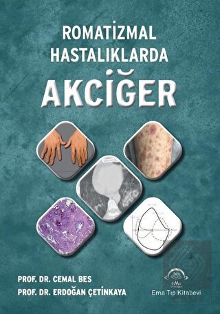 Romatizmal Hastalıklarda Akciğer