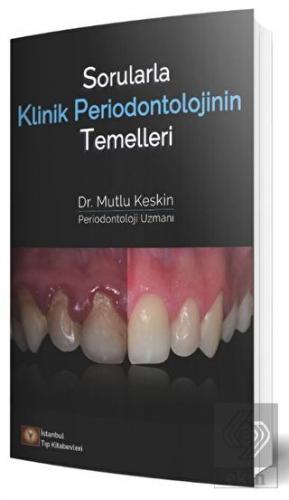 Sorularla Klinik Periodontolojinin Temelleri