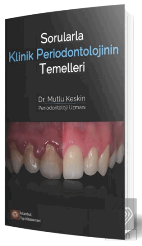 Sorularla Klinik Periodontolojinin Temelleri